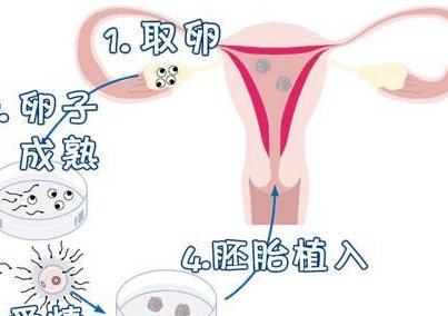 湖南无结婚证试管基因检测，未婚PGS／PGD费用差异+2026医院推荐